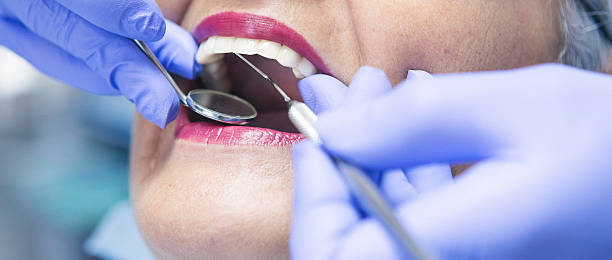 Best Knocked-Out Tooth Emergency  in Cactus, TX